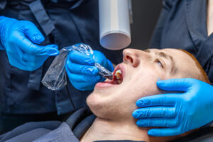 How to Choose the Best Dentist for a Root Canal in San Pedro